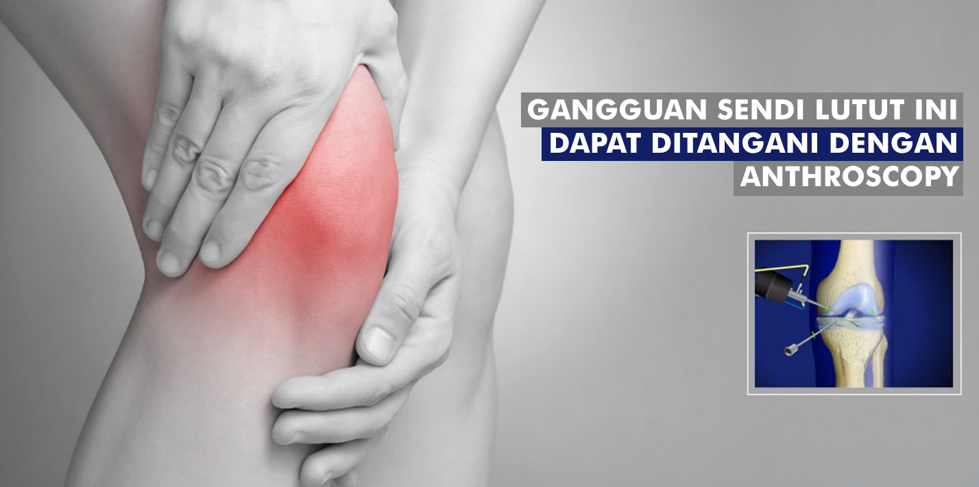 Gangguan Sendi Lutut Ini Dapat Ditangani Dengan Arthroscopy